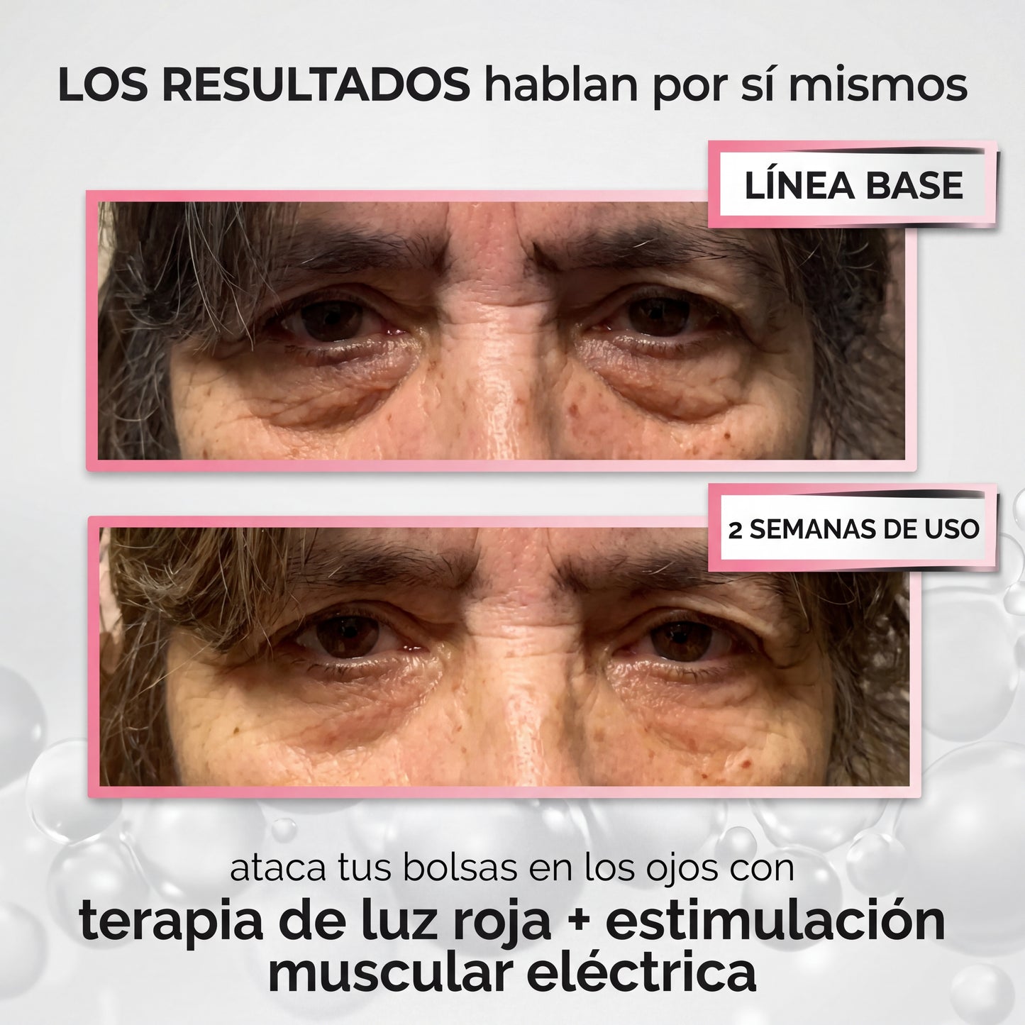 RevitalEye®