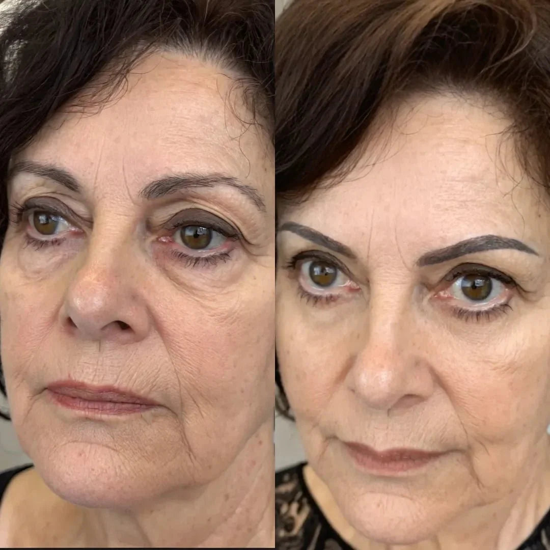 RevitalEye®